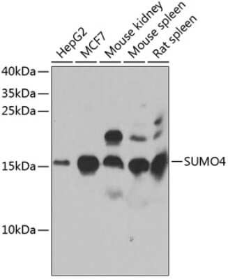 Western Blot: SUMO4 Antibody [NBP2-93213] - Analysis of extracts of various cell lines, using SUMO4 . Exposure time: 40s.