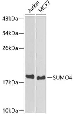 Western Blot: SUMO4 Antibody [NBP2-95198] - Analysis of extracts of various cell lines, using SUMO4 at 1:800 dilution. Secondary antibody: HRP Goat Anti-Rabbit IgG (H+L) at 1:10000 dilution. Lysates/proteins: 25ug per lane. Blocking buffer: 3% nonfat dry milk in TBST.