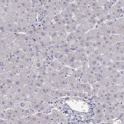 Immunohistochemistry-Paraffin: SUNC1 Antibody [NBP3-17117] - Staining of human liver shows low expression as expected.