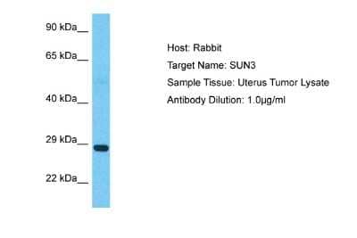 Western Blot: SUNC1 Antibody [NBP2-85843] - Host: Rabbit. Target Name: SUN3. Sample Type: Uterus Tumor lysates. Antibody Dilution: 1ug/ml