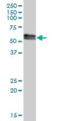 Western Blot: SUOX Antibody [H00006821-B01P] - Analysis of SUOX expression in human liver.