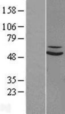 Western Blot: SUOX Overexpression Lysate (Adult Normal) [NBP2-08617] Left-Empty vector transfected control cell lysate (HEK293 cell lysate); Right -Over-expression Lysate for SUOX.