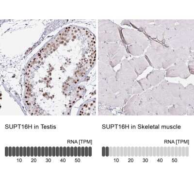 Immunohistochemistry-Paraffin: SUPT16H Antibody [NBP2-38607] - Staining in human testis and skeletal muscle tissues using anti-SUPT16H antibody. Corresponding SUPT16H RNA-seq data are presented for the same tissues.