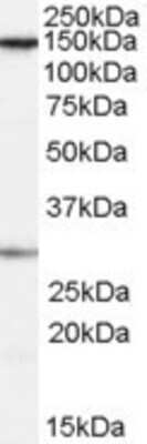 Western Blot SUPT16H Antibody