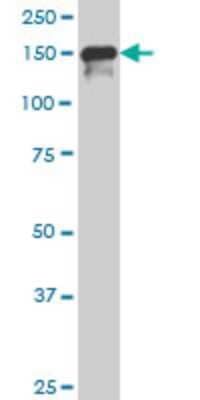 Western Blot: SUPT5H Antibody (3F1) [H00006829-M01] - SUPT5H monoclonal antibody (M01), clone 3F1 Analysis of SUPT5H expression in Hela S3 NE.