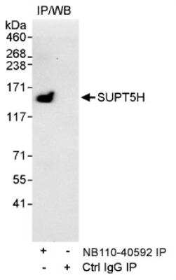 Immunoprecipitation: SUPT5H Antibody [NB110-40592] - Detection of Human SUPT5H by Western Blot of  Immunoprecipitate.  Samples:  Whole cell lysate (1 mg for IP,  20% of IP loaded) from HeLa cells. Antibodies:  Affinity purified  rabbit anti-SUPT5H antibody NB110-40592  used for IP at 3 mcg/mg lysate.  Detection:  Chemiluminescence with an exposure time of 30  seconds.