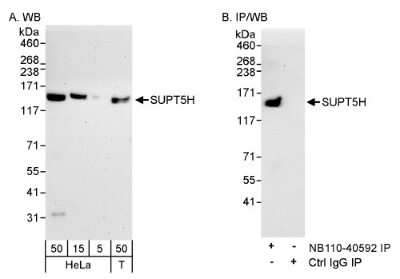 Western Blot: SUPT5H Antibody [NB110-40593] - Detection of Human SUPT5H on HeLa whole cell lysate using NB110-40593. SUPT5H was immunoprecipitated by rabbit anti-SUPT5H antibody NB110-40592.