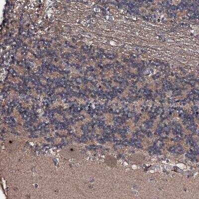 Immunohistochemistry: SUPT7L Antibody [NBP1-93722] - Staining of human cerebellum shows distinct nucleolar positivity in purkinje cells.