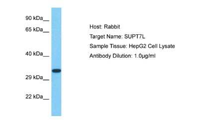 Western Blot: SUPT7L Antibody [NBP2-85844] - Host: Rabbit. Target Name: SUPT7L. Sample Type: HepG2 Whole Cell lysates. Antibody Dilution: 1.0ug/ml