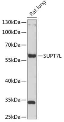 Western Blot: SUPT7L Antibody [NBP2-93096] - Analysis of extracts of Rat lung, using SUPT7L at 1:1000 dilution.Secondary antibody: HRP Goat Anti-Rabbit IgG (H+L) at 1:10000 dilution.Lysates/proteins: 25ug per lane.Blocking buffer: 3% nonfat dry milk in TBST.Detection: ECL Basic Kit .Exposure time: 15s.