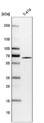 Western Blot: SUR-8 Antibody [NBP1-87831] - Analysis in human cell line T-47d.