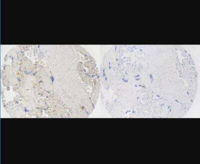 Immunohistochemistry: SUR1 Antibody [NBP2-34077] - IHC using NBP2-34077 at a dilution of 1:50 on FFPE human placenta. Primary antibody was incubated overnight at 4 C, then secondary HRP conjugate applied for 1 hour RT and visualized with DAB. HIER performed with citrate buffer pH 6.0 at 95 C for 15 minutes. Antibody incubation with 10x immunogenic peptide shows no staining. Image submitted by a verified customer review. 