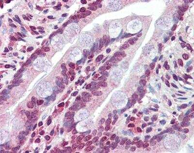 Immunohistochemistry-Paraffin: SUR1 Antibody [NBP1-59778] - Human small intestine tissue at an antibody concentration of 4-8ug/ml.