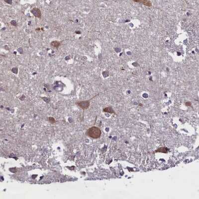 Immunohistochemistry-Paraffin: SUR1 Antibody [NBP2-34077] - Staining of human cerebral cortex shows moderate cytoplasmic positivity in neurons.