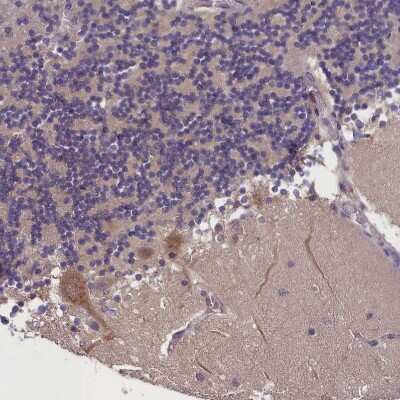 Immunohistochemistry-Paraffin: SUR1 Antibody [NBP2-34077] - Staining of human cerebellum shows strong cytoplasmic positivity in purkinje cells.