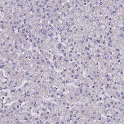 Immunohistochemistry-Paraffin: SUR1 Antibody [NBP2-34077] - Staining of human liver shows no positivity in hepatocytes as expected.