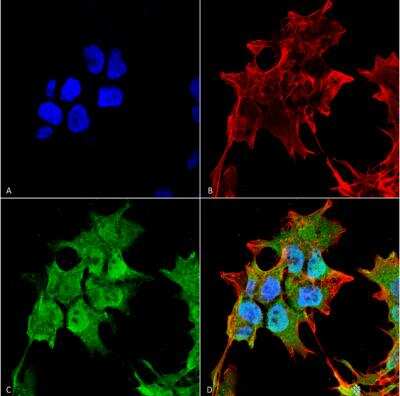 Immunocytochemistry/Immunofluorescence: SUR1 Antibody (S289-16) [NBP2-59320] - Analysis using Mouse Anti-SUR1 Monoclonal Antibody, Clone S289-16.  Tissue: Neuroblastoma cell line SK-N-BE. Species: Human. Fixation: 4% Formaldehyde for 15 min at RT. Primary Antibody: Mouse Anti-SUR1 Monoclonal Antibody at 1:100 for 60 min at RT. Secondary Antibody: Goat Anti-Mouse ATTO 488 at 1:100 for 60 min at RT. Counterstain: Phalloidin Texas Red F-Actin stain; DAPI (blue) nuclear stain at 1:1000, 1:5000 for 60min RT, 5min RT. Localization: Cytoplasm, Nucleus. Magnification: 60X. (A) DAPI (blue) nuclear stain (B) Phalloidin Texas Red F-Actin stain (C) SUR1 Antibody (D) Composite.