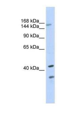 Western Blot: SUR1 Antibody [NBP1-59778] - 293T cell lysate, Antibody Titration: 0.2-1 ug/ml