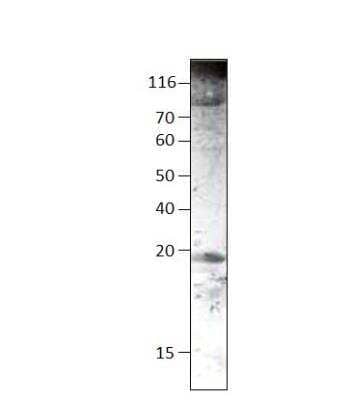 Western Blot: SUR1 Antibody [NBP3-12497] - 1:10000 antibody dilution in DiluOBuffer. Apparent MW is 18.5 KDa.