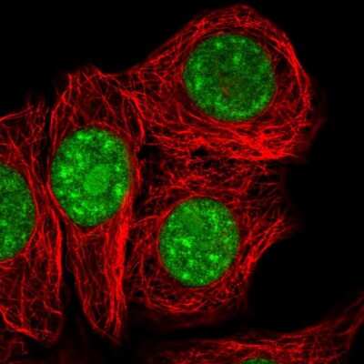 Immunocytochemistry/Immunofluorescence: SURF2 Antibody [NBP2-56730] - Staining of human cell line MCF7 shows localization to nucleoli & nuclear speckles.