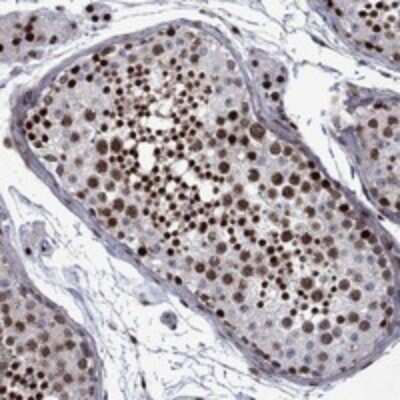 Immunohistochemistry-Paraffin: SURF2 Antibody [NBP3-17544] - Staining of human testis shows strong nuclear positivity in cells in seminiferous ducts and Leydig cells.