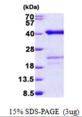 SDS-PAGE Recombinant Human SURF2 His Protein