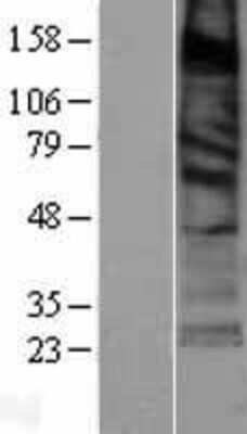Western Blot: SURF4 Overexpression Lysate (Adult Normal) [NBP2-04408] Left-Empty vector transfected control cell lysate (HEK293 cell lysate); Right -Over-expression Lysate for SURF4.