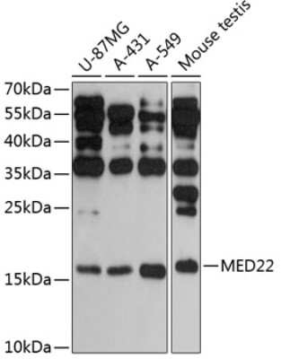 Western Blot: SURF5 Antibody [NBP2-93744] - Analysis of extracts of various cell lines, using SURF5 .Exposure time: 30s.