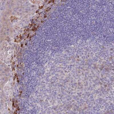 Immunohistochemistry-Paraffin: SUSD1 Antibody [NBP2-13401] - Staining of human tonsil shows strong cytoplasmic positivity in a subset of leukocytes.