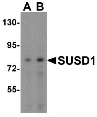 Western Blot: SUSD1 Antibody [NBP2-61129] - Analysis of SUSD1 in 293 cell lysate with SUSD1 antibody at (A) 0.5 and (B) 1 ug/mL.