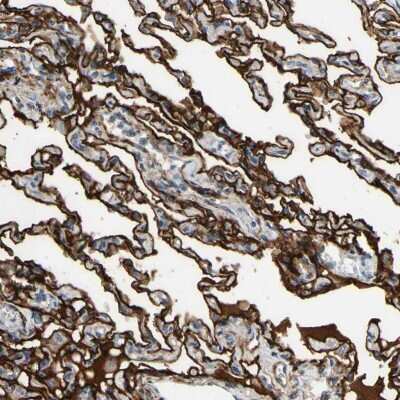 Immunohistochemistry-Paraffin: SUSD2 Antibody [NBP1-88589] - Staining of human lung shows high expression.