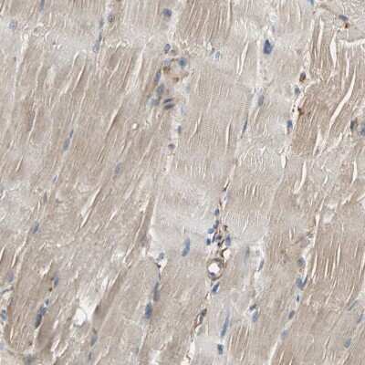 Immunohistochemistry-Paraffin: SUSD2 Antibody [NBP1-88589] - Staining of human skeletal muscle shows low expression as expected.