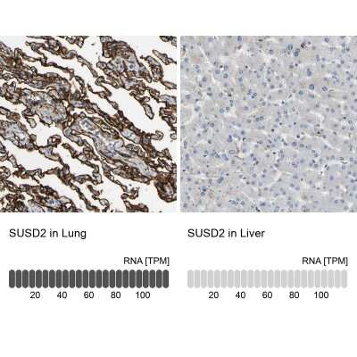 Immunohistochemistry-Paraffin: SUSD2 Antibody [NBP1-88589] - Analysis in human lung and liver tissues using NBP1-88589 antibody. Corresponding SUSD2 RNA-seq data are presented for the same tissues.