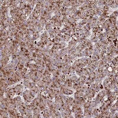 Immunohistochemistry-Paraffin: SUSD3 Antibody [NBP1-82723] - Staining of human liver shows moderate granular cytoplasmic positivity in hepatocytes.