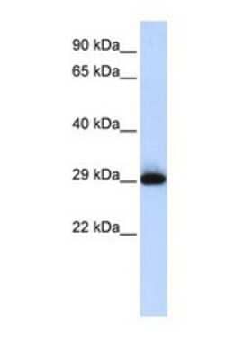 Western Blot: SUSD3 Antibody [NBP1-69242] - This Anti-SUSD3 antibody was used in Western Blot of Placenta tissue lysate at a concentration of 1ug/ml.