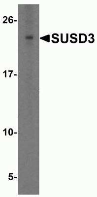 Western Blot: SUSD3 Antibody [NBP2-82017] - Western blot analysis of SUSD3 in HeLa cell lysate with SUSD3 antibody at 1 ug/ml.