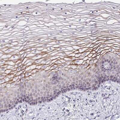 Immunohistochemistry-Paraffin SUSD4 Antibody - BSA Free