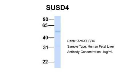Western Blot SUSD4 Antibody - BSA Free