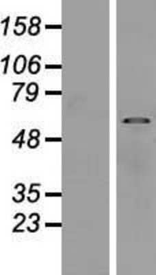 Western Blot: SUSD4 Overexpression Lysate (Adult Normal) [NBP2-06892] Left-Empty vector transfected control cell lysate (HEK293 cell lysate); Right -Over-expression Lysate for SUSD4.