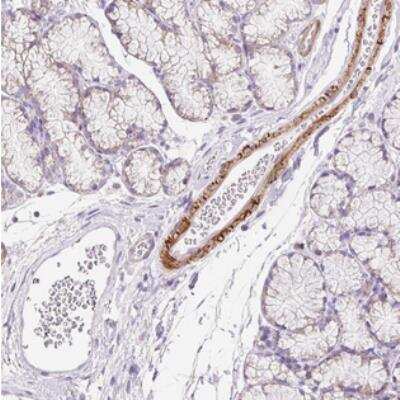 Immunohistochemistry-Paraffin: SUSD5 Antibody [NBP2-30803] - Staining of human duodenum shows membranous and cytoplasmic positivity in vessel walls.