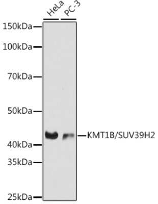 Western Blot: SUV39H2 Antibody (6L2D9) [NBP3-16258] - Western blot analysis of extracts of various cell lines, using SUV39H2 antibody (NBP3-16258) at 1:1000 dilution. Secondary antibody: HRP Goat Anti-Rabbit IgG (H+L) at 1:10000 dilution. Lysates/proteins: 25ug per lane. Blocking buffer: 3% nonfat dry milk in TBST. Detection: ECL Basic Kit. Exposure time: 30s.