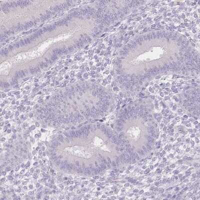Immunohistochemistry-Paraffin: SUV39H2 Antibody [NBP2-38828] - Staining of human endometrium shows low expression as expected.