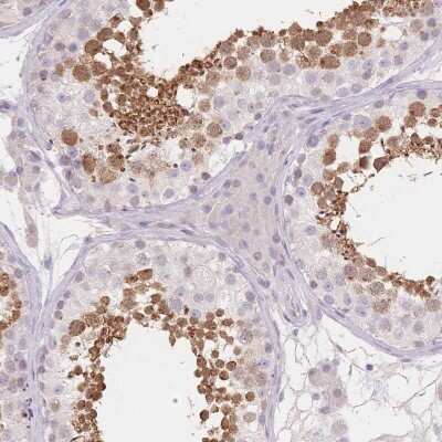 Immunohistochemistry-Paraffin: SUV39H2 Antibody [NBP2-38828] - Staining of human testis shows high expression.
