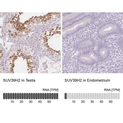 <b>Orthogonal Strategies Validation. </b>Immunohistochemistry-Paraffin: SUV39H2 Antibody [NBP2-38828] - Staining in human testis and endometrium tissues using anti-SUV39H2 antibody. Corresponding SUV39H2 RNA-seq data are presented for the same tissues.