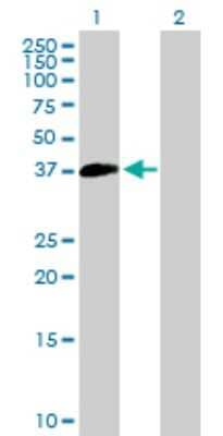 Western Blot: SUV39H2 Antibody [H00079723-B01P] - Analysis of SUV39H2 expression in transfected 293T cell line by SUV39H2 polyclonal antibody.  Lane 1: SUV39H2 transfected lysate(38.5 KDa). Lane 2: Non-transfected lysate.