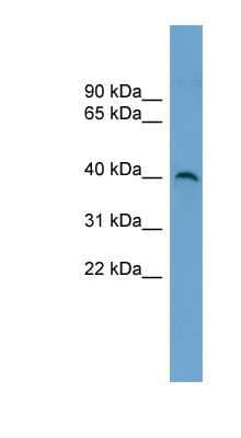 Western Blot: SUV39H2 Antibody [NBP1-57056] - HepG2 cell lysate, concentration 0.2-1 ug/ml.