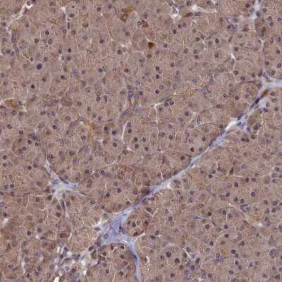 Immunohistochemistry-Paraffin SUV3L1 Antibody