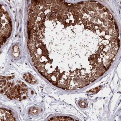 Immunohistochemistry-Paraffin SUV3L1 Antibody