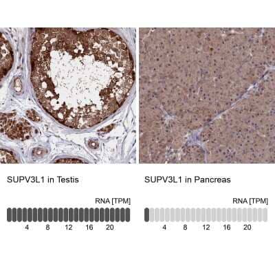 Immunohistochemistry-Paraffin SUV3L1 Antibody