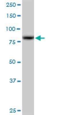 Western Blot: SUV3L1 Antibody [H00006832-B01P] - SUPV3L1 MaxPab polyclonal antibody. Western Blot analysis of SUPV3L1 expression in A-431.
